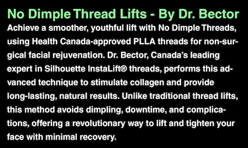 No Dimple Threads PLLA Facial Lifting Mississauga Oakville